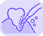 清洁牙龈线菌斑.png